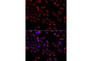 Immunofluorescence analysis of A549 cells using SLC22A11 antibody (ABIN5975730).