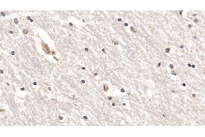 Detection of IL18R1 in Human Cerebrum Tissue using Monoclonal Antibody to Interleukin 18 Receptor 1 (IL18R1) (IL18R1 antibody  (AA 375-428))