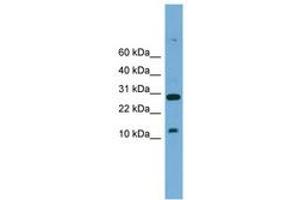 Image no. 1 for anti-T-Cell Acute Lymphocytic Leukemia 2 (TAL2) (AA 51-100) antibody (ABIN6744552) (TAL2 antibody  (AA 51-100))