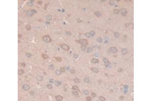 Figure. (MGP antibody  (AA 1-103))