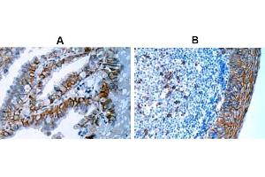 Immunohistochemistry (IHC) image for anti-Syndecan 1 (SDC1) antibody (ABIN487501) (Syndecan 1 antibody)