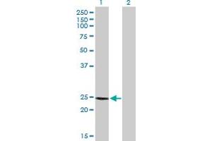 Western Blot analysis of CALB1 expression in transfected 293T cell line by CALB1 MaxPab polyclonal antibody. (CALB1 antibody  (AA 1-261))