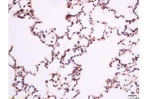 Paraformaldehyde-fixed, paraffin embedded rat lung, Antigen retrieval by boiling in sodium citrate buffer (pH6) for 15min, Block endogenous peroxidase by 3% hydrogen peroxide for 30 minutes, Blocking buffer (normal goat serum) at 37°C for 20min, Antibody incubation with Rabbit Anti-PLC gamma 1 (Tyr783) Polyclonal Antibody, Unconjugated  at 1:200 overnight at 4°C, followed by a conjugated secondary for 90 minutes and DAB staining (Phospholipase C gamma 1 antibody  (pTyr783))