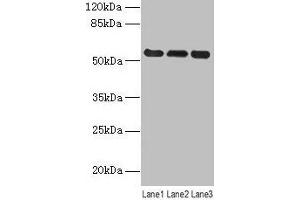 Western blot All lanes: VIM antibody at 8 μg/mL Lane 1: Hela whole cell lysate Lane 2: Jurkat whole cell lysate Lane 3: A549 whole cell lysate Secondary Goat polyclonal to rabbit IgG at 1/10000 dilution Predicted band size: 54 kDa Observed band size: 54 kDa (Vimentin antibody  (AA 2-466))