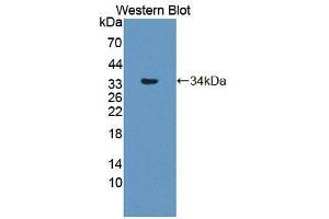Western blot analysis of the recombinant protein. (Phospholipase C delta 3 antibody  (AA 528-789))
