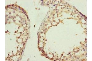 Immunohistochemistry of paraffin-embedded human testis tissue using ABIN7157234 at dilution of 1:100 (KANSL3 antibody  (AA 1-200))