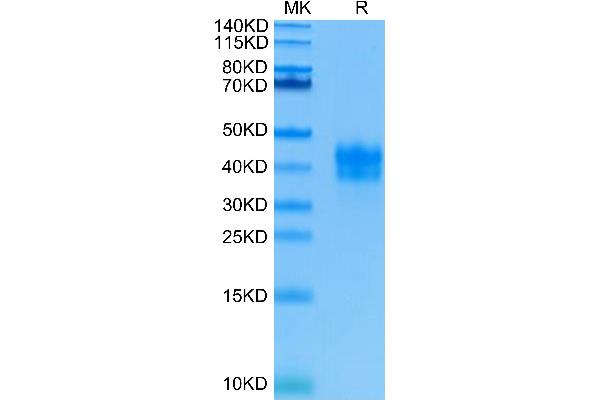 TNFRSF1A Protein (AA 30-211) (His tag)