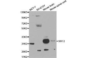 Western blot analysis of extracts of various cell lines, using SIRT2 antibody. (SIRT2 antibody  (AA 288-389))