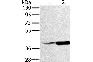 Western blot analysis of Hela and A549 cell, using NDUFA10 Polyclonal Antibody at dilution of 1:500