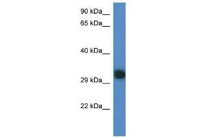 WB Suggested Anti-Gm527 Antibody Titration: 1. (GM527 antibody  (C-Term))