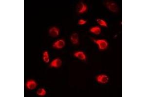 Immunofluorescent analysis of Carbonic Anhydrase 3 staining in Hela cells.