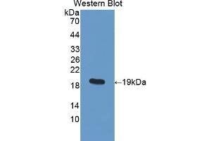Detection of Recombinant PDIA5, Human using Polyclonal Antibody to Protein Disulfide Isomerase A5 (PDIA5) (PDIA5 antibody  (AA 378-506))