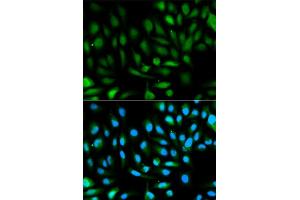 Immunofluorescence analysis of HeLa cells using PARK7 antibody (ABIN5970375). (PARK7/DJ1 antibody)