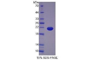 SDS-PAGE analysis of Human OPA3 Protein. (OPA3 Protein)