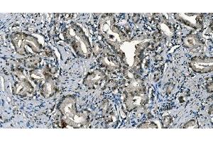 IHC analysis of CDC45L using anti-CDC45L antibody (ABIN7600230). (CDC45 antibody  (AA 166-431))