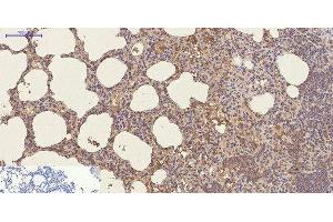 Immunohistochemistry of paraffin-embedded Mouse lung tissue using CD23 Monoclonal Antibody at dilution of 1:200. (FCER2 antibody)