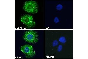 ABIN184748 Immunofluorescence analysis of paraformaldehyde fixed A431 cells, permeabilized with 0. (ARPC2 antibody  (C-Term))