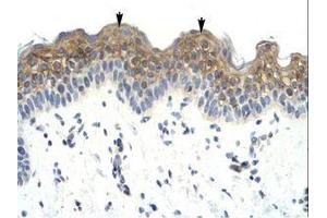 Image no. 1 for anti-LW-1 (HSFX1) (AA 224-273) antibody (ABIN6735980) (HSFX1 antibody  (AA 224-273))