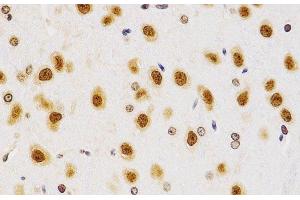 Immunohistochemistry of paraffin-embedded Rat brain using Asymmetric DiMethyl-Histone H4-R3 Polyclonal Antibody at dilution of 1:200 (40x lens).