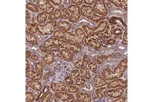 Immunohistochemical staining of human kidney with C15orf23 polyclonal antibody  shows strong cytoplasmic positivity in tubular cells at 1:50-1:200 dilution. (KNSTRN antibody)