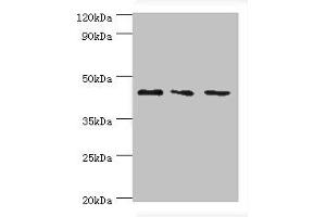 Western blot All lanes: CHI3L2 antibody at 4 μg/mL Lane 1: Hela whole cell lysate Lane 2: Rat brain tissue Lane 3: A431 whole cell lysate Secondary Goat polyclonal to rabbit IgG at 1/10000 dilution Predicted band size: 44, 35, 43 kDa Observed band size: 44 kDa (CHI3L2 antibody  (AA 27-390))