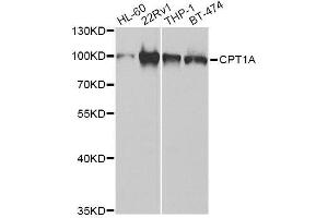 Western blot analysis of extracts of various cell lines, using CPT1A Antibody. (CPT1A antibody  (AA 497-756))
