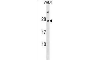 Western Blotting (WB) image for anti-TGFB-Induced Factor Homeobox 2-Like, Y-Linked (TGIF2LY) antibody (ABIN3000164) (TGIF2LY antibody)