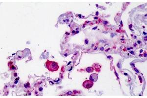 Human Lung: Formalin-Fixed, Paraffin-Embedded (FFPE) (SMO antibody  (AA 68-117))