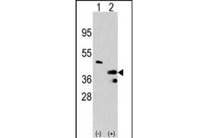 Western blot analysis of PRMT1 (arrow) using rabbit polyclonal PRMT1 Antibody (C-term) (R). (PRMT1 antibody  (C-Term))