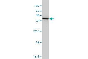 GSS monoclonal antibody (M03), clone 4B6-2C7. (Glutathione Synthetase antibody)