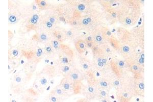 DAB staining on IHC-P; Samples: Human Liver Tissue (COL18 antibody  (AA 1572-1754))