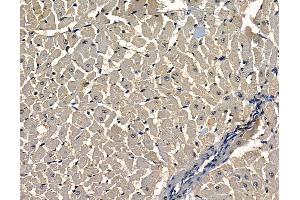ABIN7097067 and ABIN7101134 at 1/100 staining rat heart tissue by IHC-P. (TMEM63C antibody)