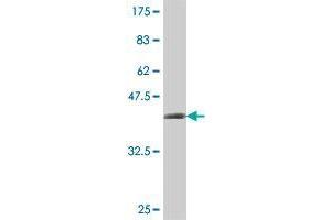 Western Blot detection against Immunogen (37 KDa) . (DIP2A antibody  (AA 1-99))