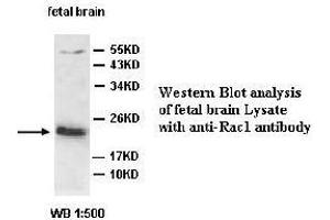 Image no. 2 for anti-RAC1 antibody (ABIN791257) (RAC1 antibody)