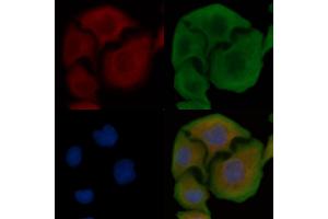 ABIN6258096 and ABIN6274395 staining Hela cells by IF/ICC. (RBM26 antibody  (Internal Region))