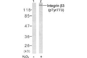 Image no. 2 for anti-Integrin beta 3 (ITGB3) (pTyr773) antibody (ABIN196721) (Integrin beta 3 antibody  (pTyr773))