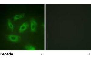 Immunofluorescence analysis of HeLa cells, using TGFBR1 polyclonal antibody . (TGFBR1 antibody  (Ser165))