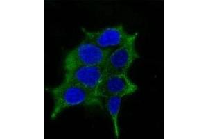 Immunofluorescence testing of LNCaP cells and Alexa Fluor 488 conjugated ODC-1 antibody. (ODC1 antibody)