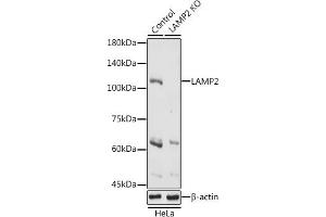 Western blot analysis of extracts of HeLa cells, using L antibody (ABIN6129969, ABIN6143081, ABIN6143082 and ABIN6218224) at 1:1000 dilution. (LAMP2 antibody  (AA 30-300))