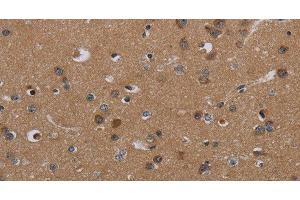 Immunohistochemistry of paraffin-embedded Human brain tissue using PDGFC Polyclonal Antibody at dilution 1:40 (PDGFC antibody)