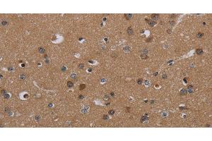Immunohistochemistry of paraffin-embedded Human brain tissue using PDGFC Polyclonal Antibody at dilution 1:40