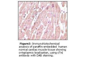 Image no. 1 for anti-Cardiac Troponin I (TNNI3) antibody (ABIN232097)