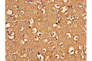 Immunohistochemistry of paraffin-embedded human brain tissue using ABIN7175266 at dilution of 1:100 (ATP6V1G2 antibody  (AA 1-118))