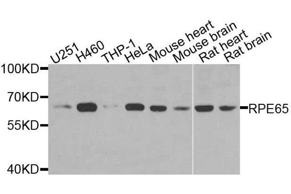 RPE65 antibody  (AA 274-533)