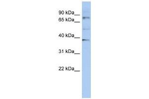 OAS2 antibody used at 1 ug/ml to detect target protein. (OAS2 antibody  (N-Term))