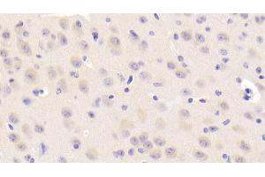 Detection of NEIL3 in Mouse Cerebrum Tissue using Polyclonal Antibody to Nei Endonuclease VIII Like Protein 3 (NEIL3) (NEIL3 antibody  (AA 2-187))