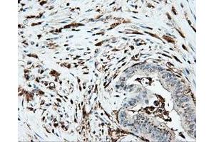 Immunohistochemical staining of paraffin-embedded Kidney tissue using anti-PLEK mouse monoclonal antibody.