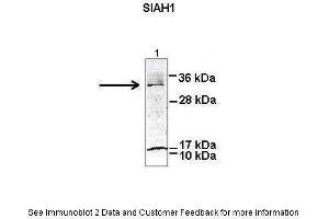 Researcher: Peter Brand & Dr. (SIAH1 antibody  (N-Term))