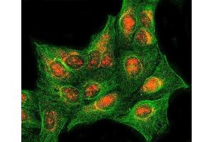 IF analysis of RASSF2 using anti-RASSF2 antibody (ABIN7599274) and anti-Tubulin Alpha antibody (ABIN7600339). (RASSF2 antibody  (AA 1-326))