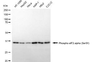 Western blotting analysis using phospho-eIF2 alpha (Ser51) antibody (ABIN7798512).